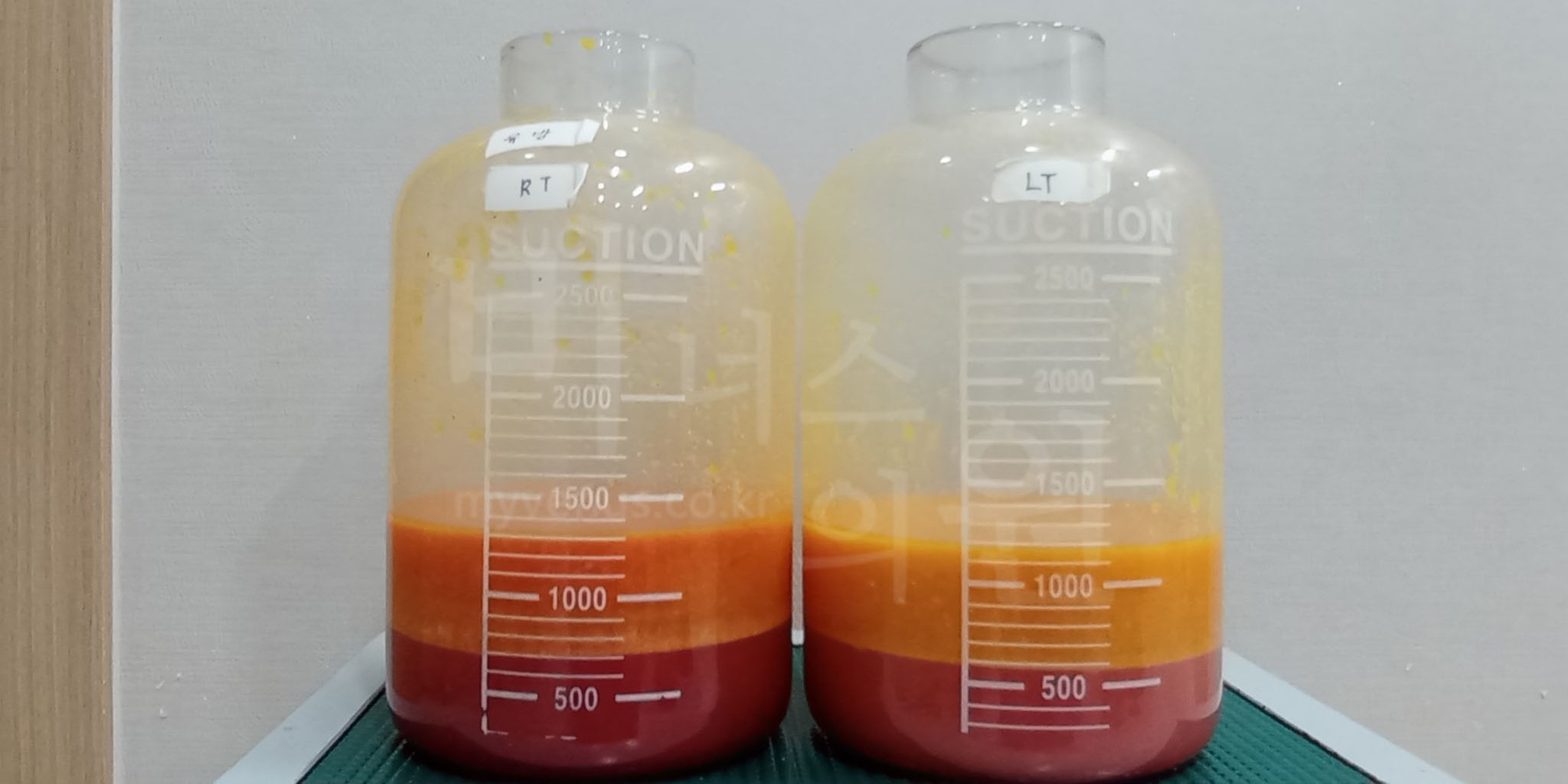 부천지방흡입 유방축소 지방흡입 상담으로 상체 라인 개선