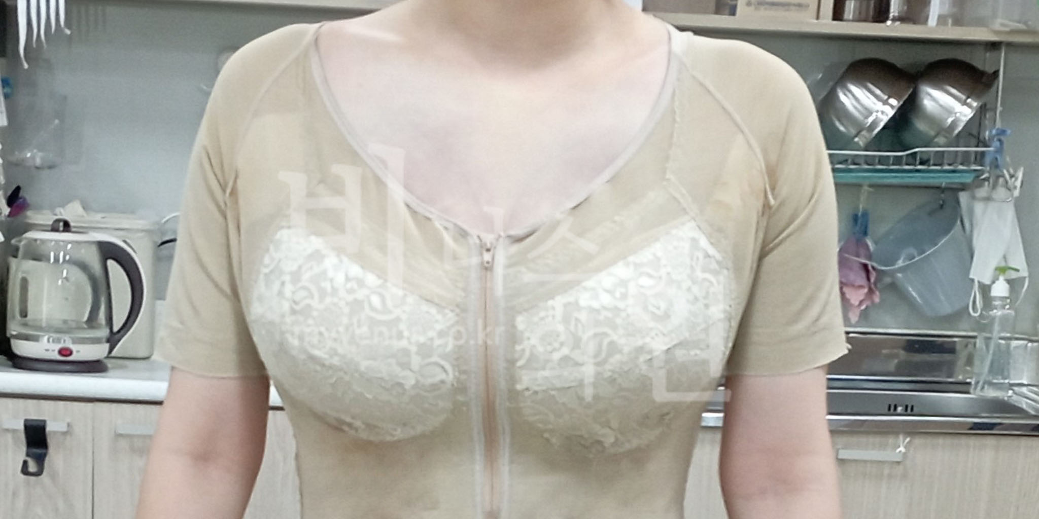 부천지방흡입 유방축소 지방흡입 후 압박복 착용과 회복 관리