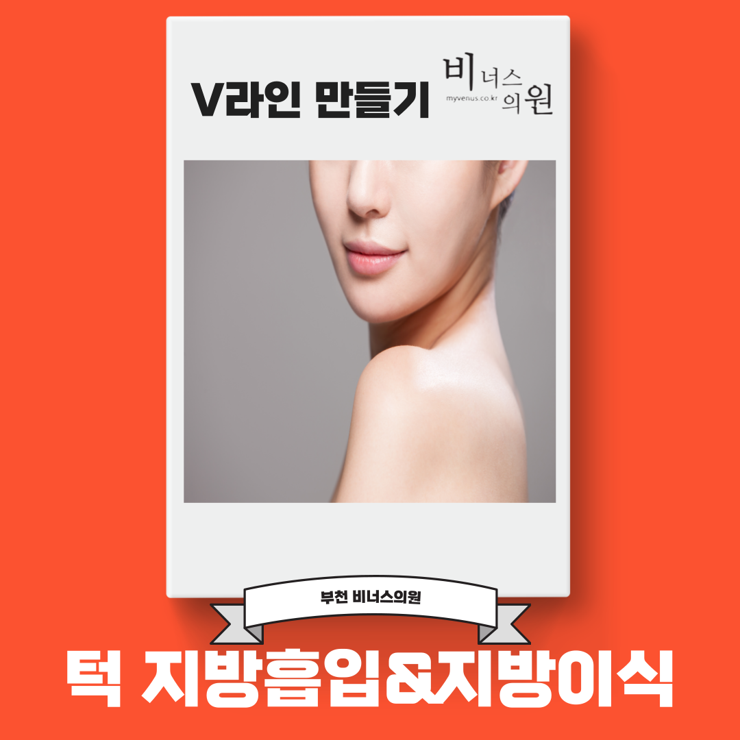 이중턱 지방흡입 수술 방식 설명 — 투메슨트 방식 턱밑 지방흡입