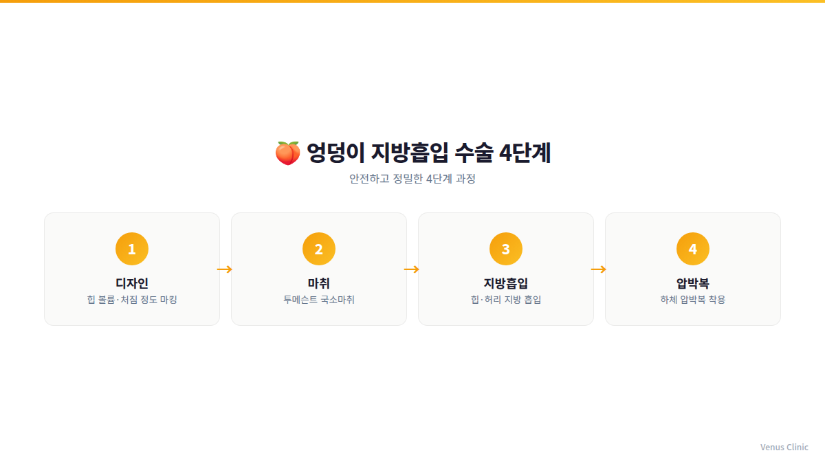 엉덩이 지방흡입 수술 단계 인포그래픽 — 비너스의원 부천
