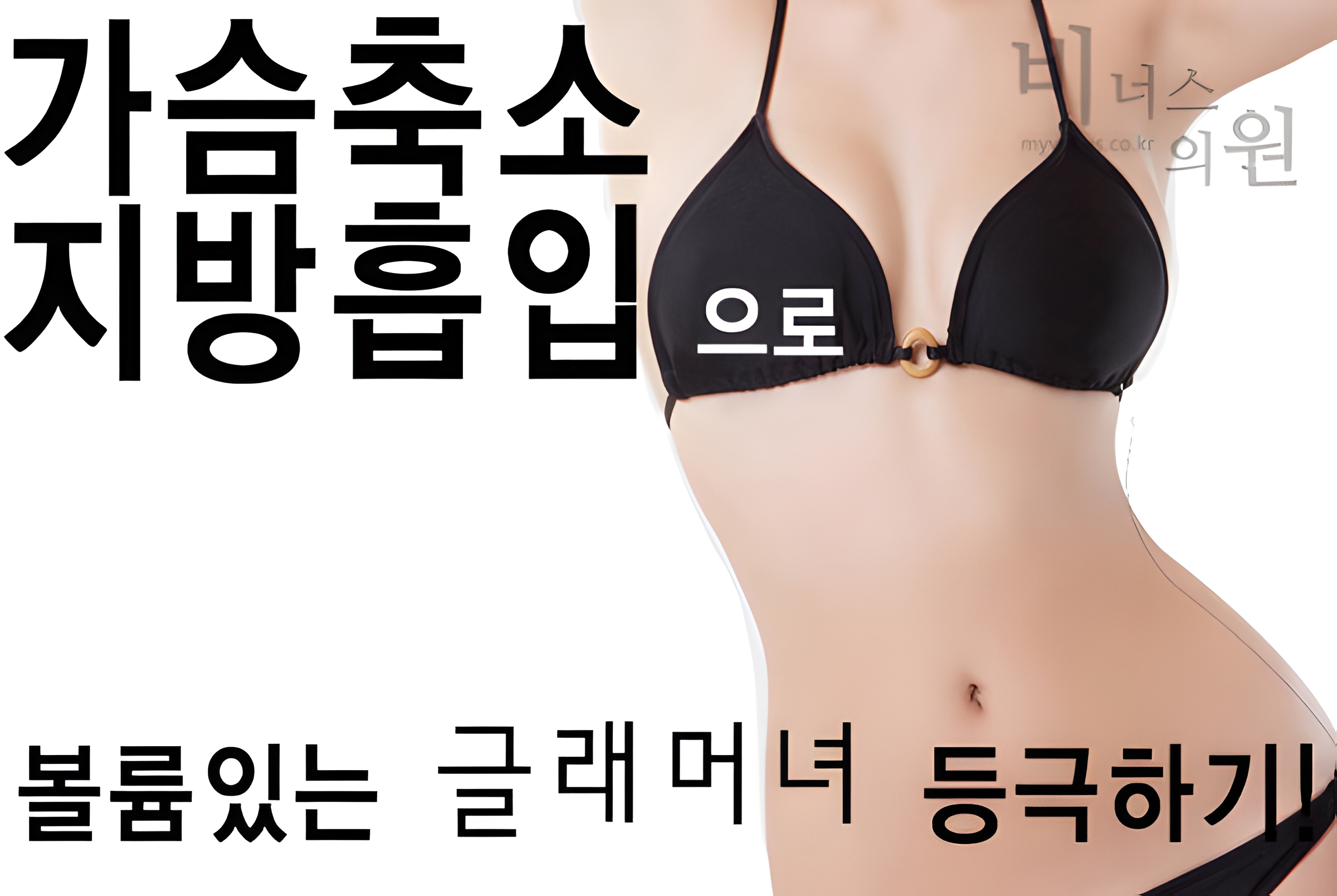 엉덩이 지방이식 볼륨업 수술 설명 이미지 — 자가 지방이식으로 볼륨 형성