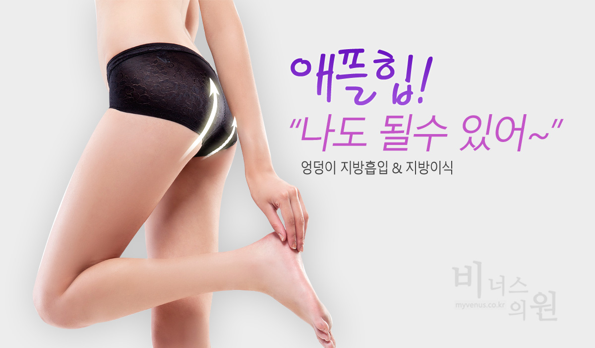 엉덩이 지방흡입 전후 비교 일러스트 — 수술 전 처진 엉덩이와 수술 후 힙업된 엉덩이 라인