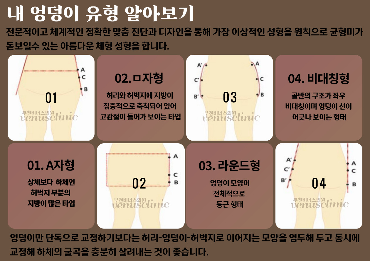 엉덩이 볼륨업 지방흡입 체형 변화 — 부천 상동역 비너스의원