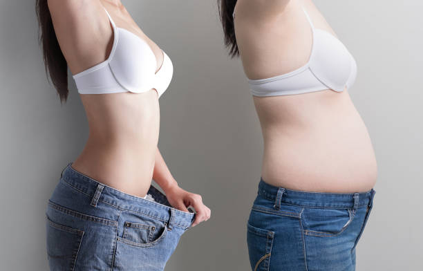 복부지방흡입 수술 전후 비교 이미지