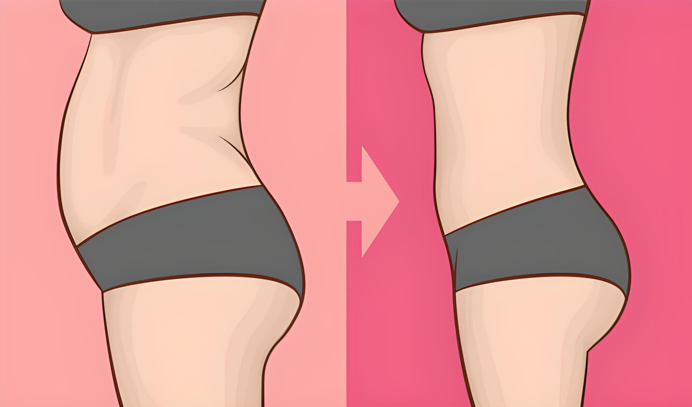 복부 지방흡입 수술 정보 이미지 — 부천 상동역 비너스의원