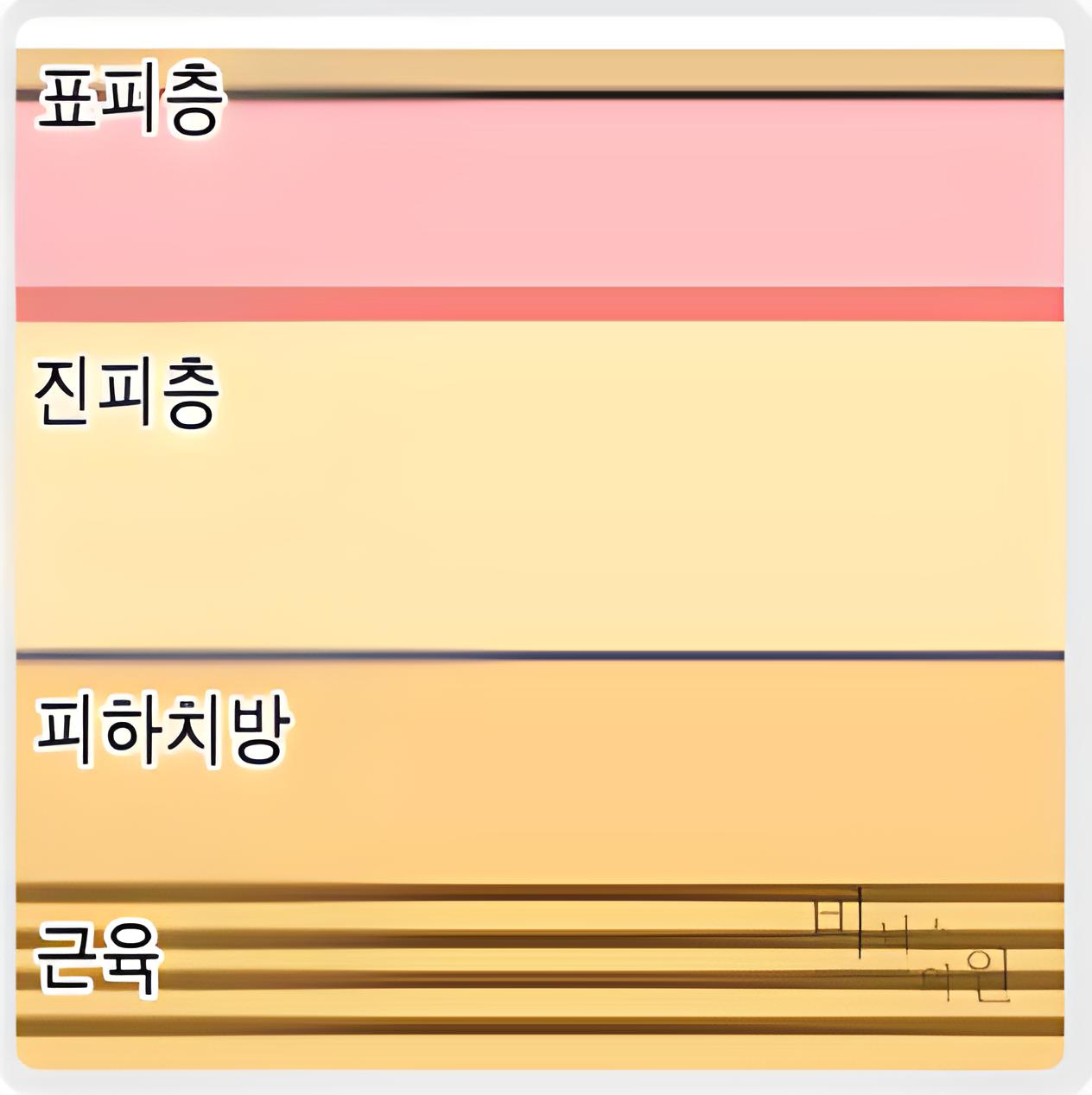 표피층 진피층 피하지방 근육 피부 구조 다이어그램