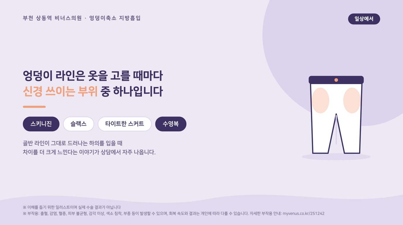 엉덩이 라인 때문에 옷 선택이 고민될 때를 설명하는 인포그래픽