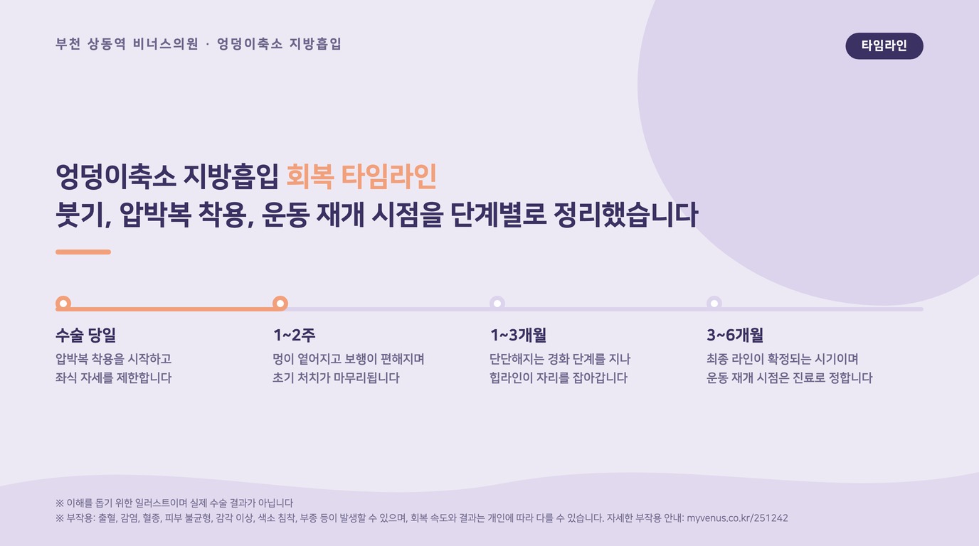 엉덩이축소 지방흡입 회복 타임라인 인포그래픽