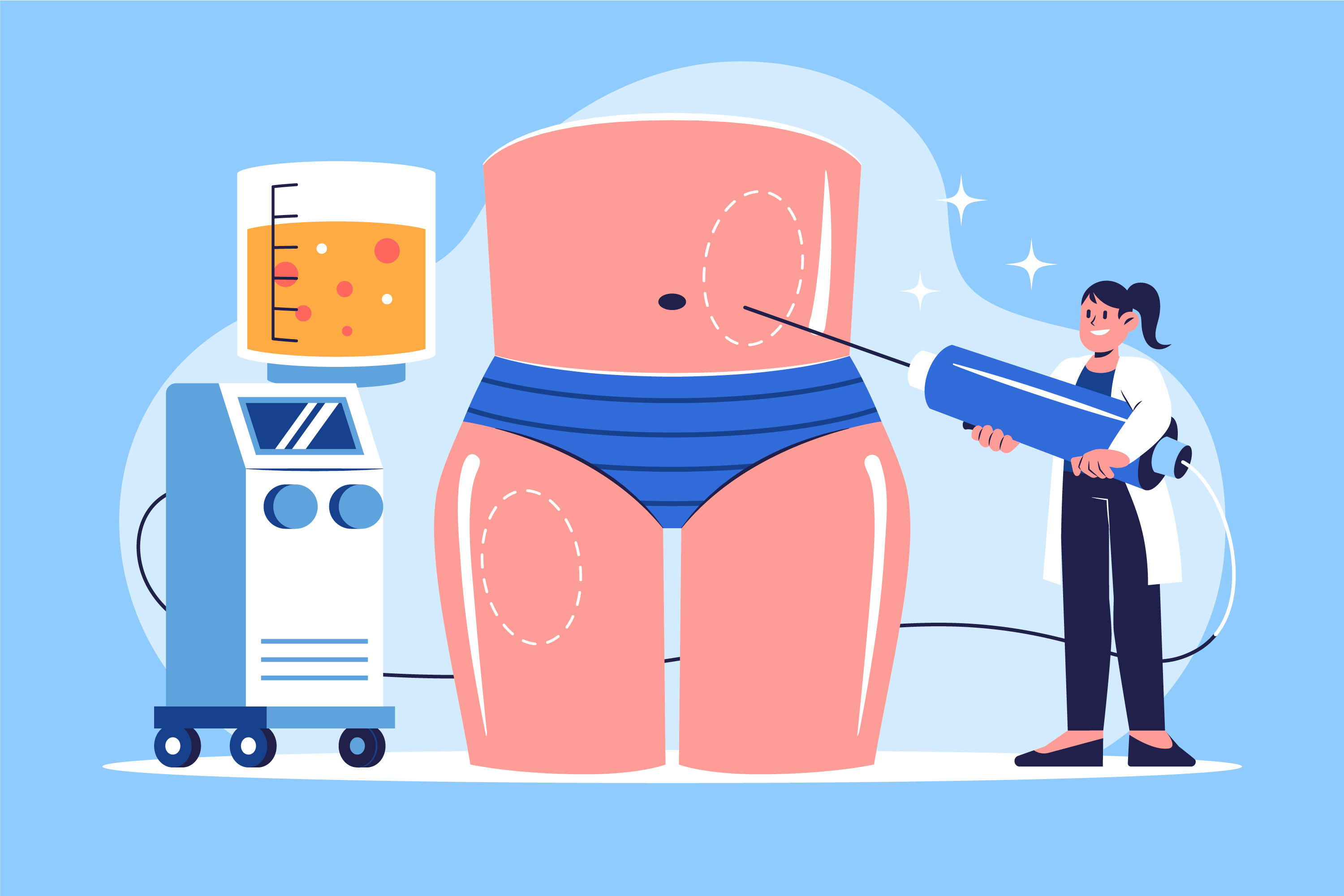 투메슨트 용액 주입과 캐뉼라를 이용한 표층 지방흡입 과정을 설명하는 인포그래픽
