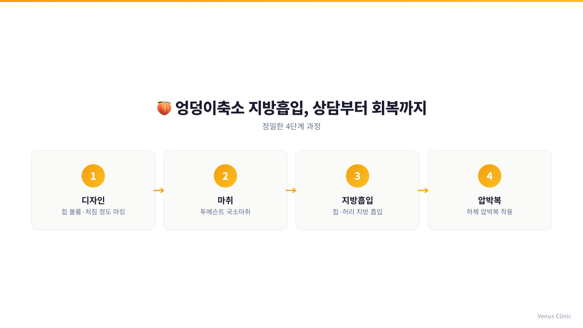 엉덩이축소 지방흡입 상담부터 회복까지 4단계 인포그래픽