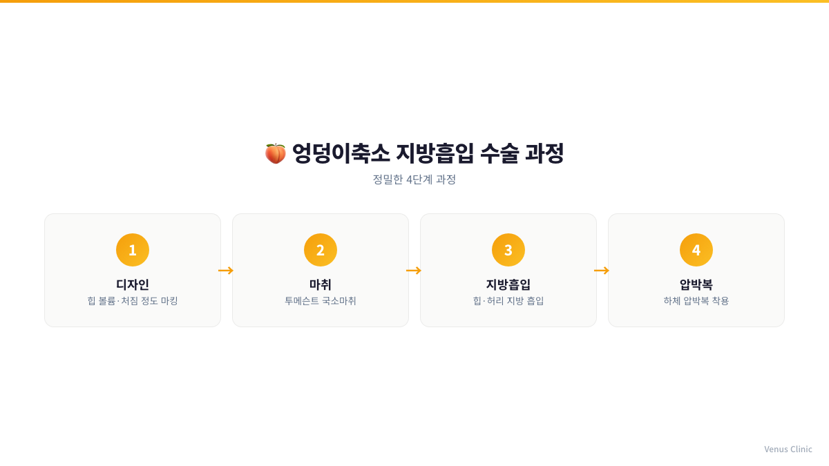 엉덩이축소 지방흡입 수술 4단계 인포그래픽