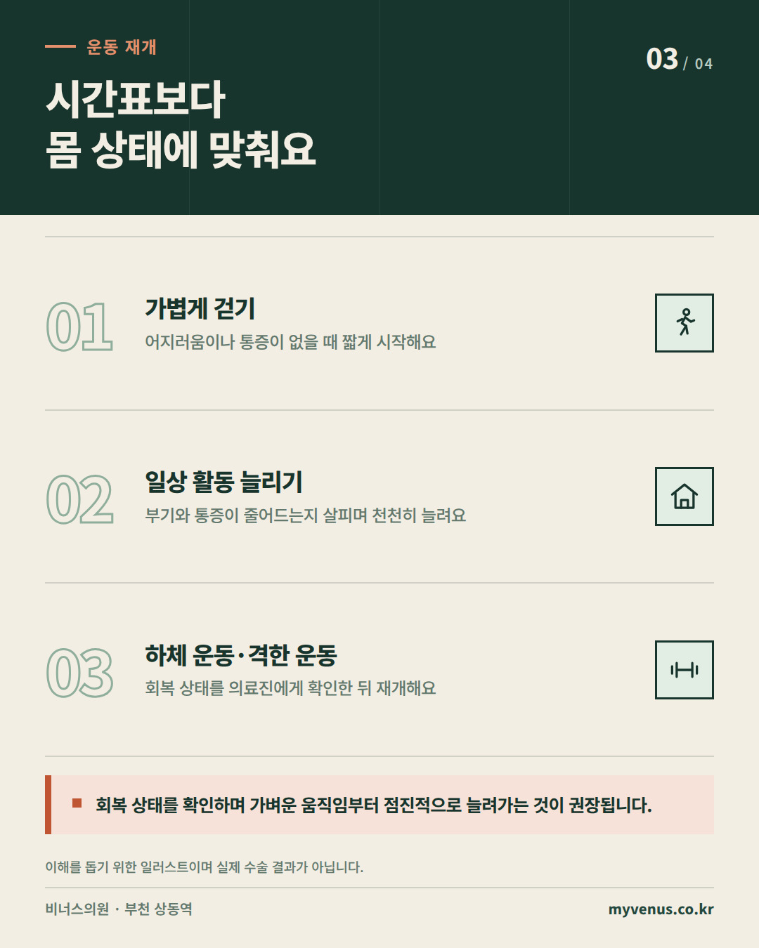 엉덩이축소 지방흡입 후 걷기부터 하체 운동까지 운동 재개 안내 인포그래픽