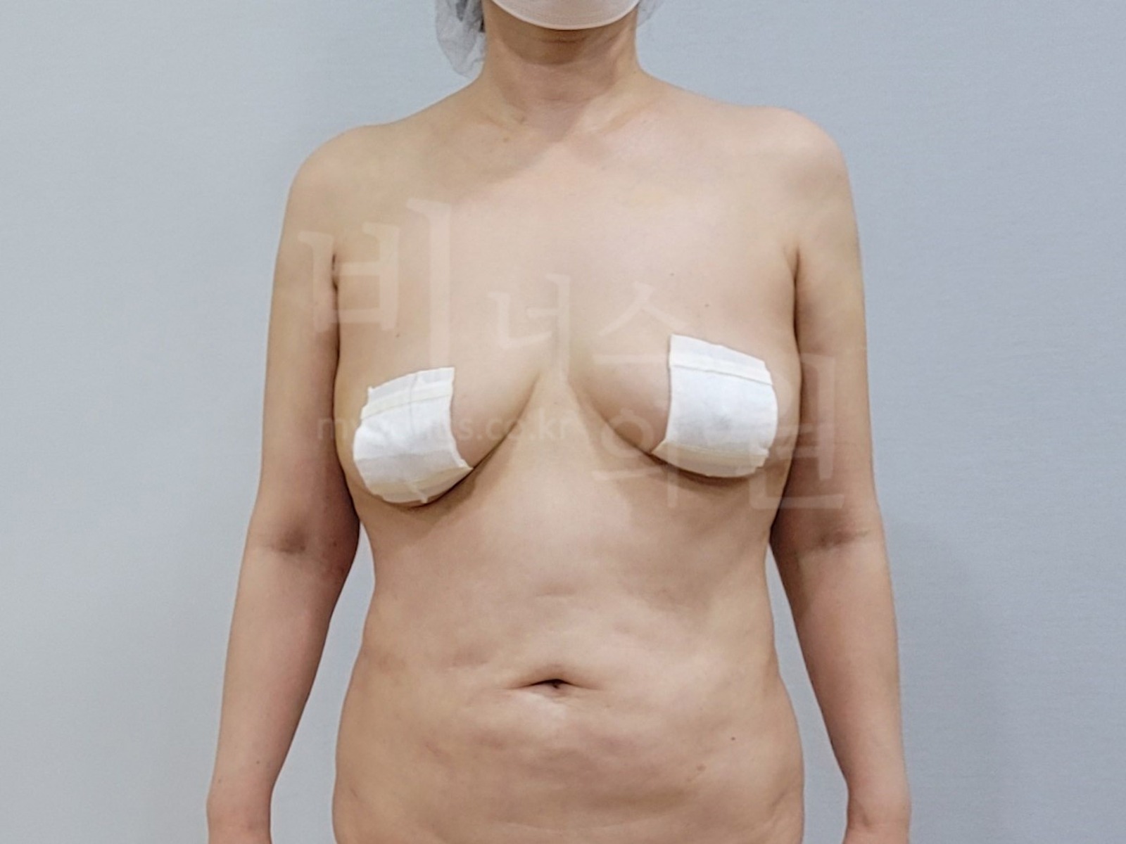팔뚝 정면 사진 예시