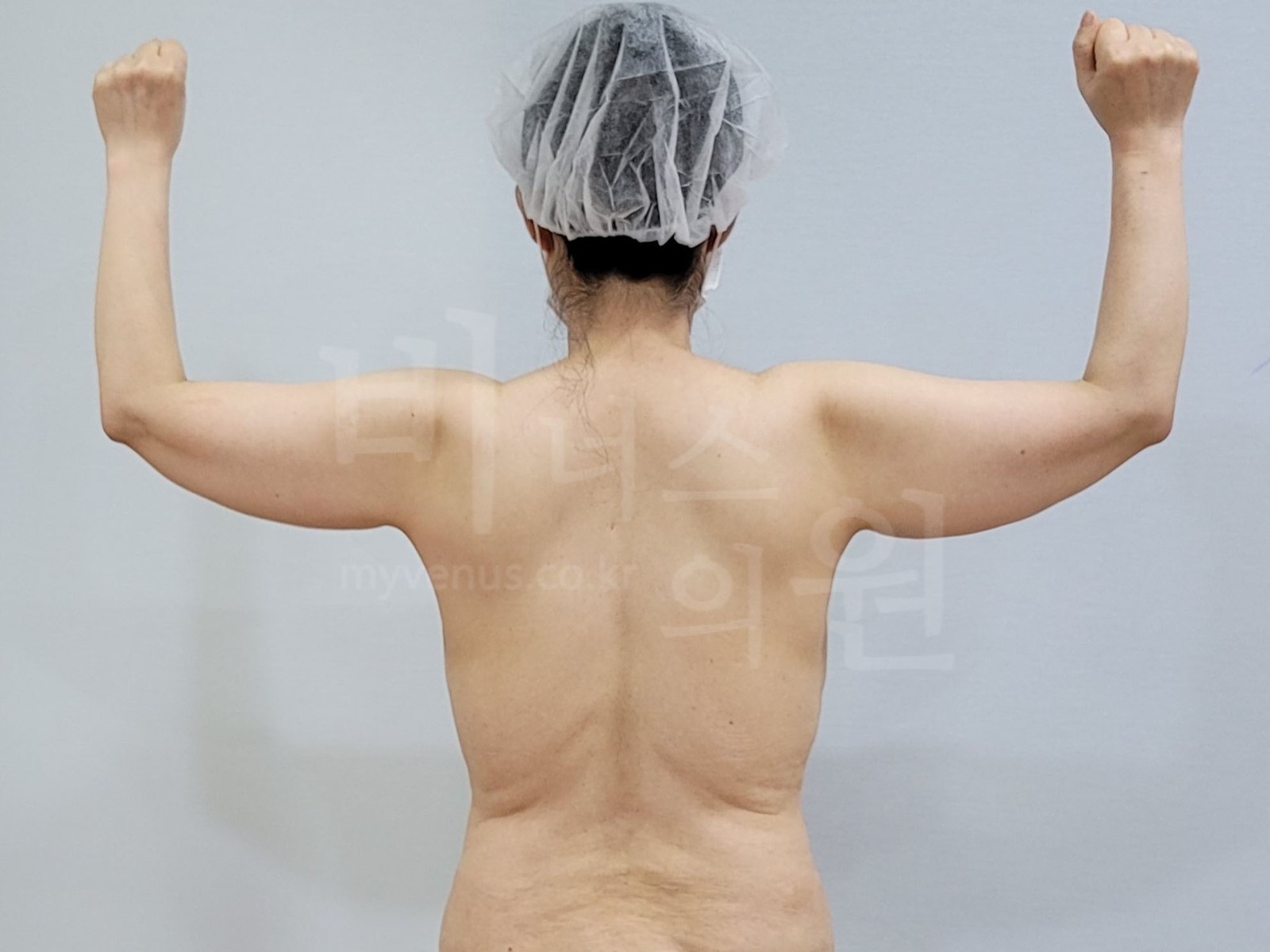 팔뚝 후면 사진 예시