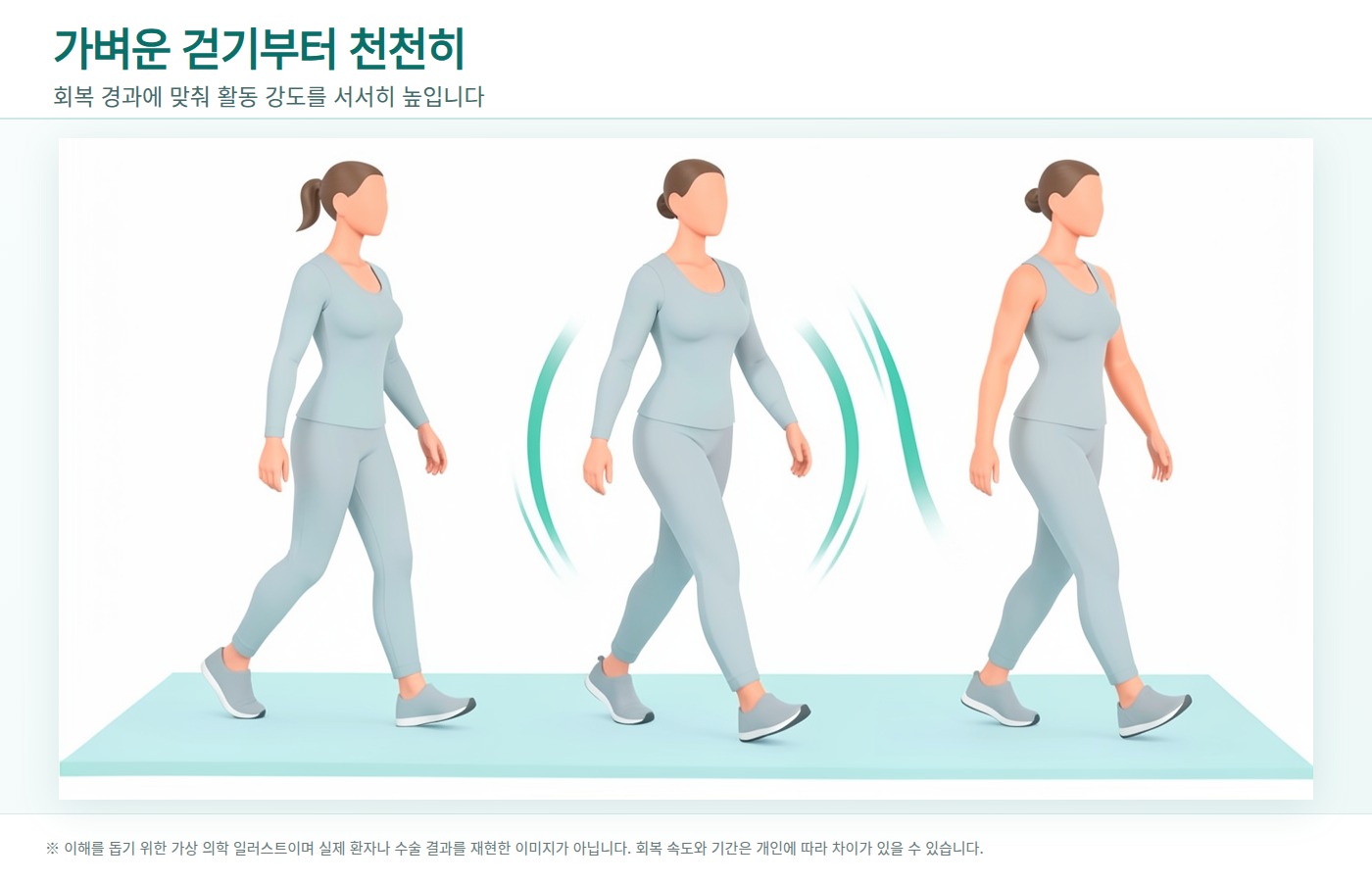 가벼운 걷기부터 활동 강도를 서서히 높이는 회복 과정을 보여주는 가상 의학 일러스트