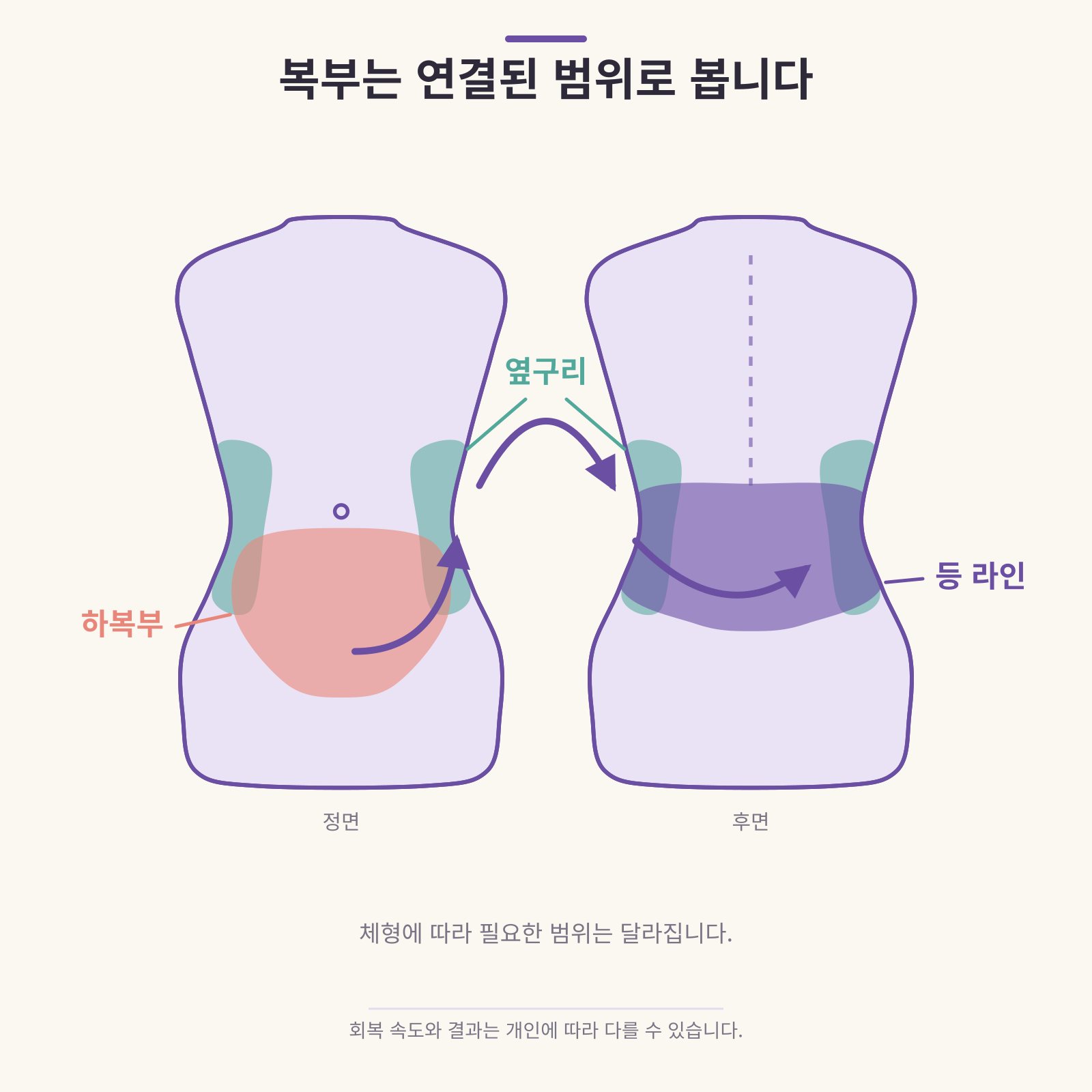복부 하복부·옆구리·등 라인의 연결 범위 의학 인포그래픽