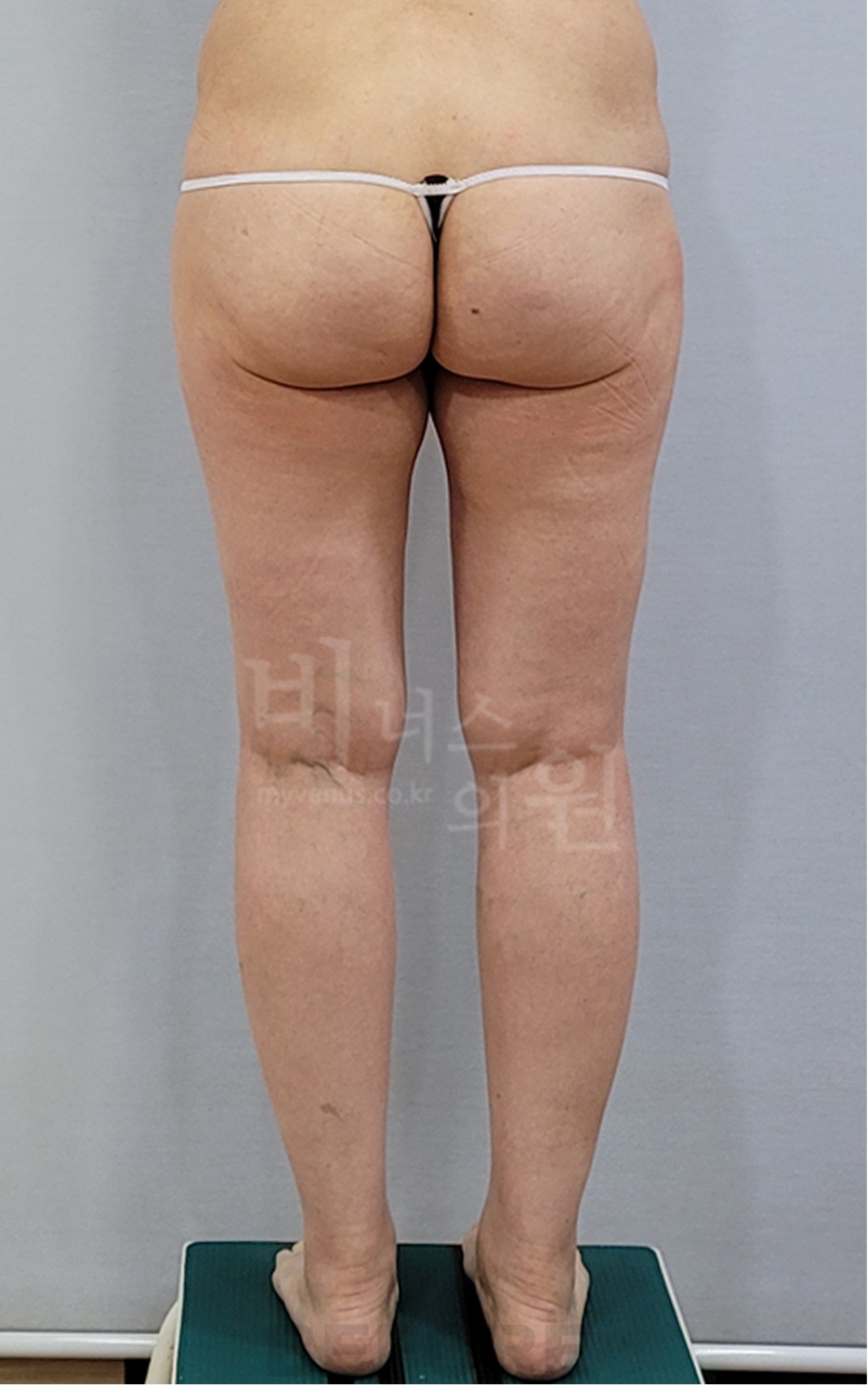 후면 촬영 2 — 왼쪽 (2025년 촬영)