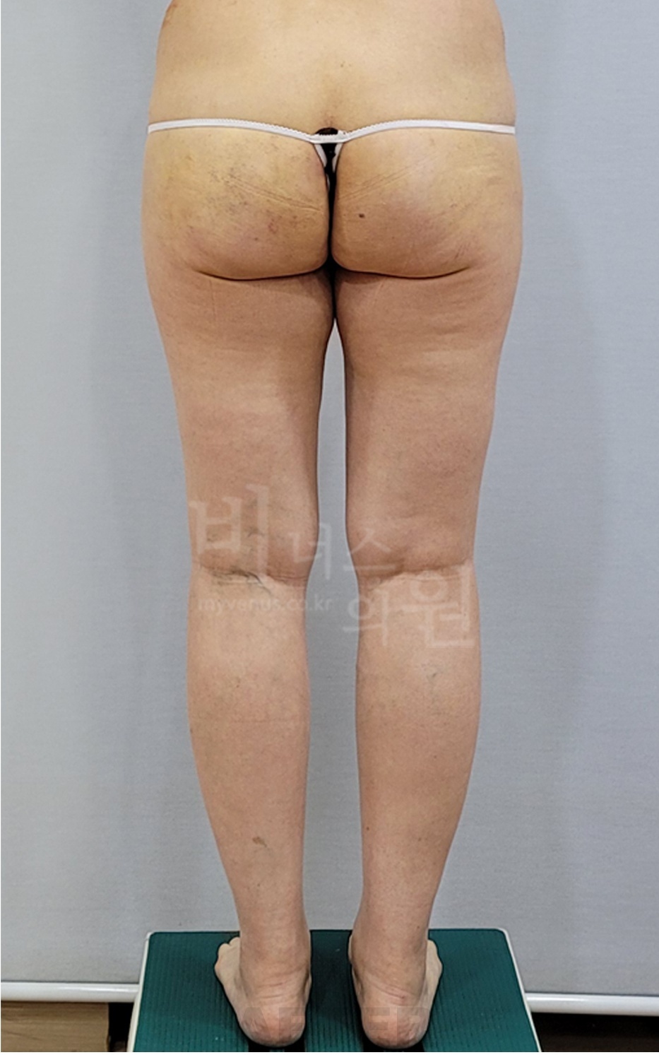 후면 촬영 2 — 오른쪽 (2025년 촬영)