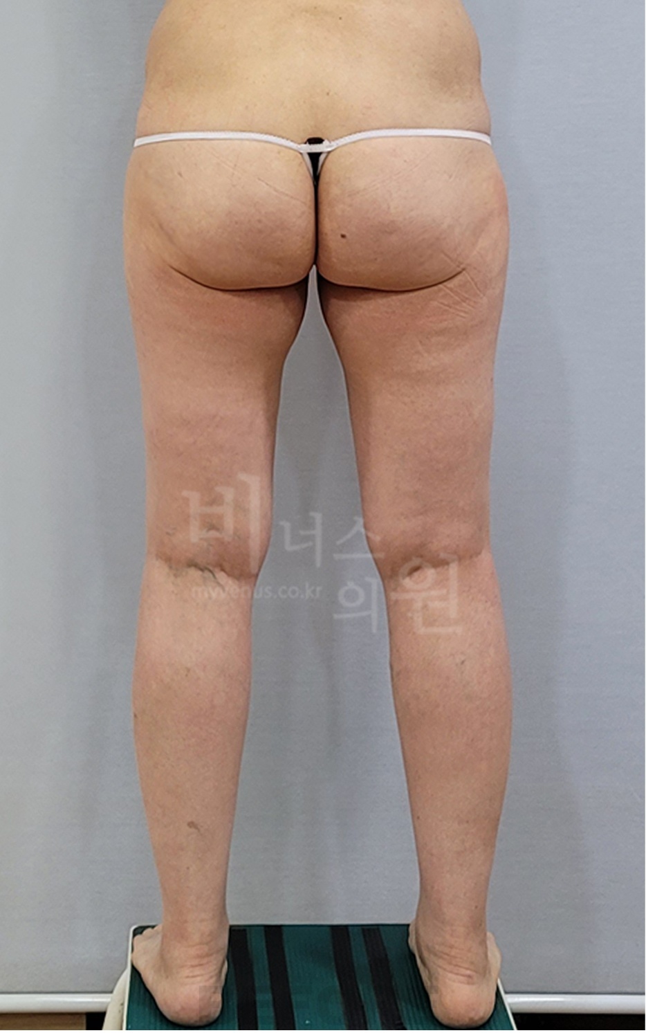 후면 촬영 3 — 왼쪽 (2025년 촬영)