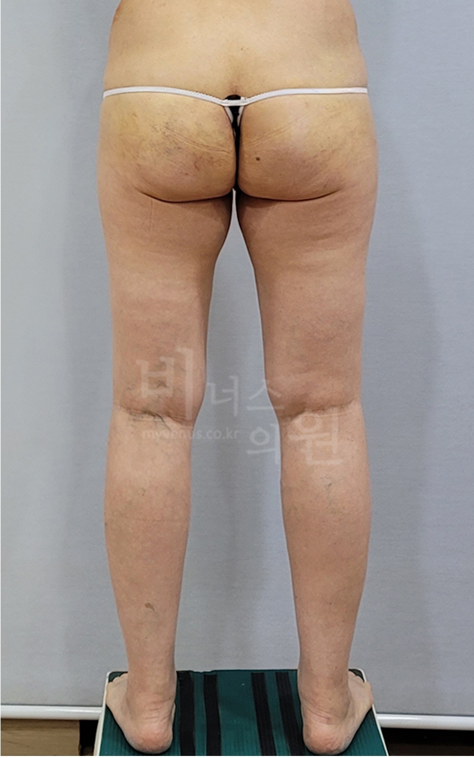 후면 촬영 3 — 오른쪽 (2025년 촬영)