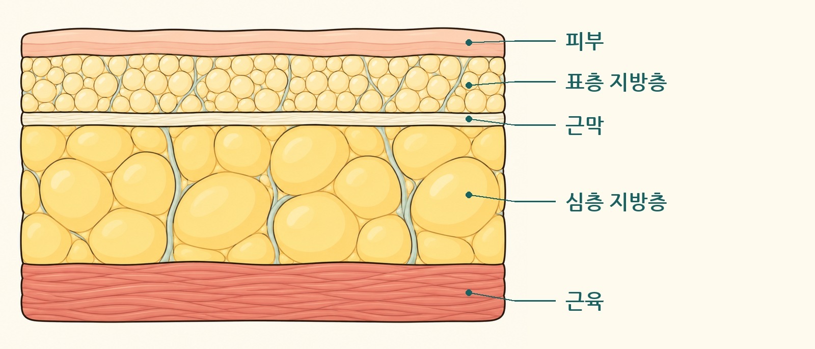 피부 아래 표층 지방층과 심층 지방층의 위치